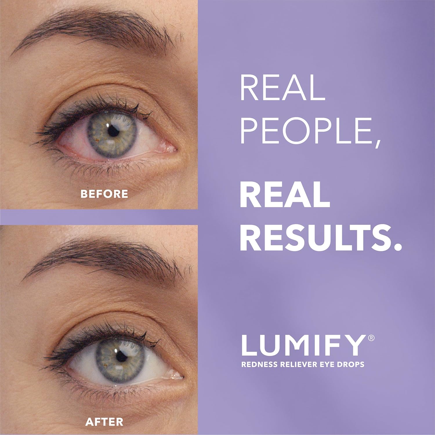 Brilliant Eye Brightener Drops