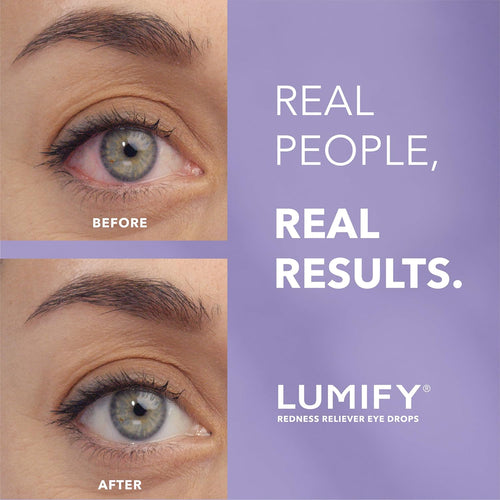 Brilliant Eye Brightener Drops